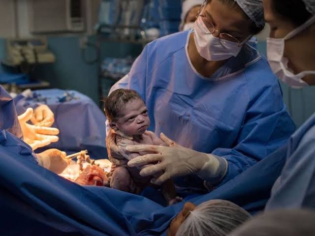 Caesarean Delivery